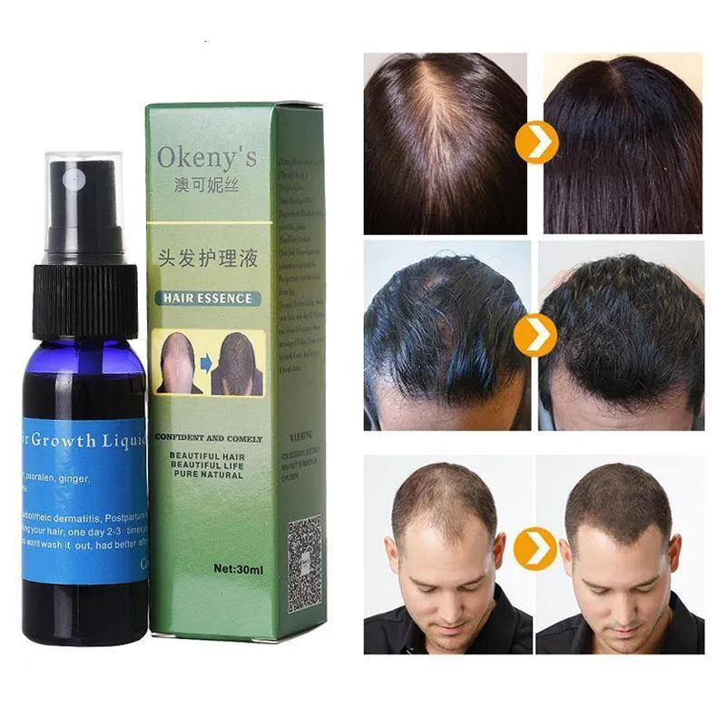 Sunburst Hair Growth Kit for Men & Women – Anti-Hair Loss Spray & Beard Oil, Natural Chinese Herbal Treatment for Alopecia & Baldness (3 x 30ml)