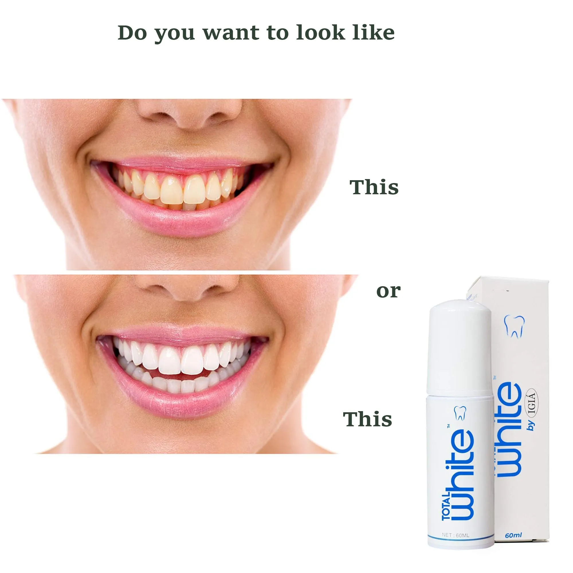 Total White Toothpaste & Whitening Gel